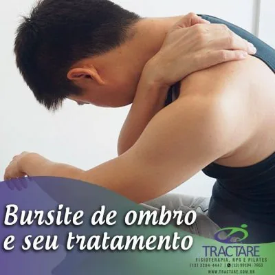 Imagem educativa sobre bursite de ombro em Santos